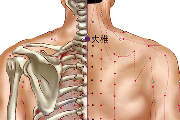 278 督脈 - 大椎